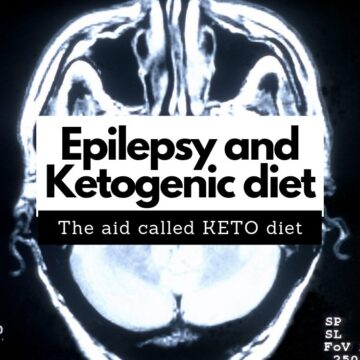Epilepsy and keto diet. Can ketogenic diet help? #keto #epilepsy #ketogenic